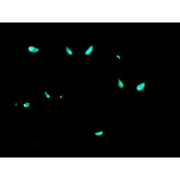 Gorgasia preclara - Prachtröhrenaal