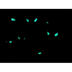 Gorgasia preclara - Prachtröhrenaal
