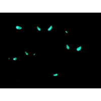 Gorgasia preclara - Prachtröhrenaal
